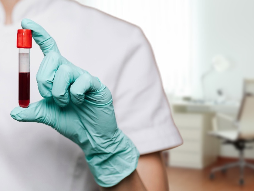 Hematologická ambulance - Masarykova nemocnice Rakovník - MUDr. Eva Mandáková, MBA