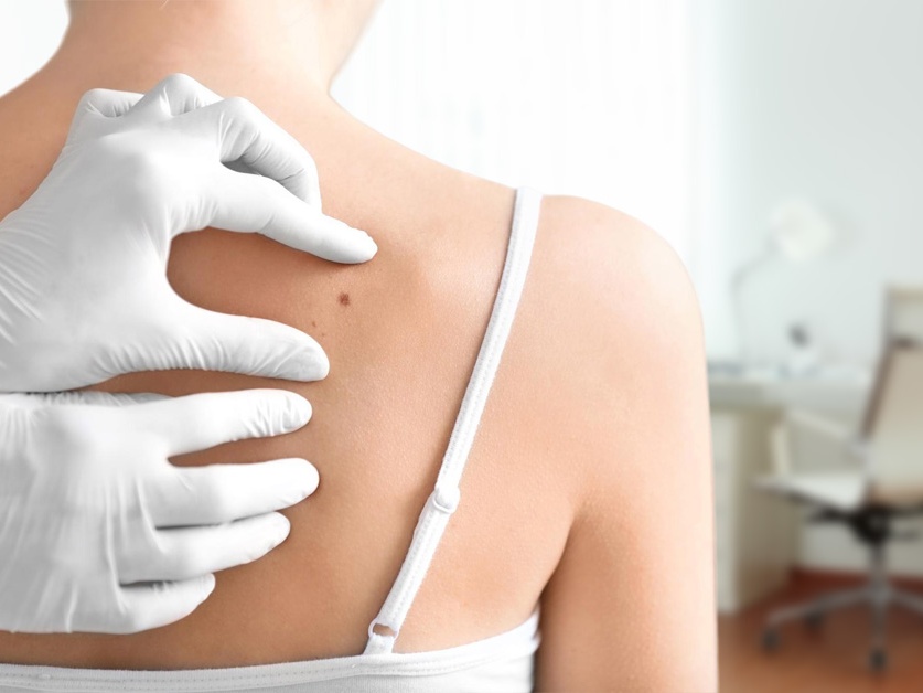 Kožní ambulance DermaEve s.r.o. - MUDr. Eva Čepelová, MUDr. Alena Ševčíková