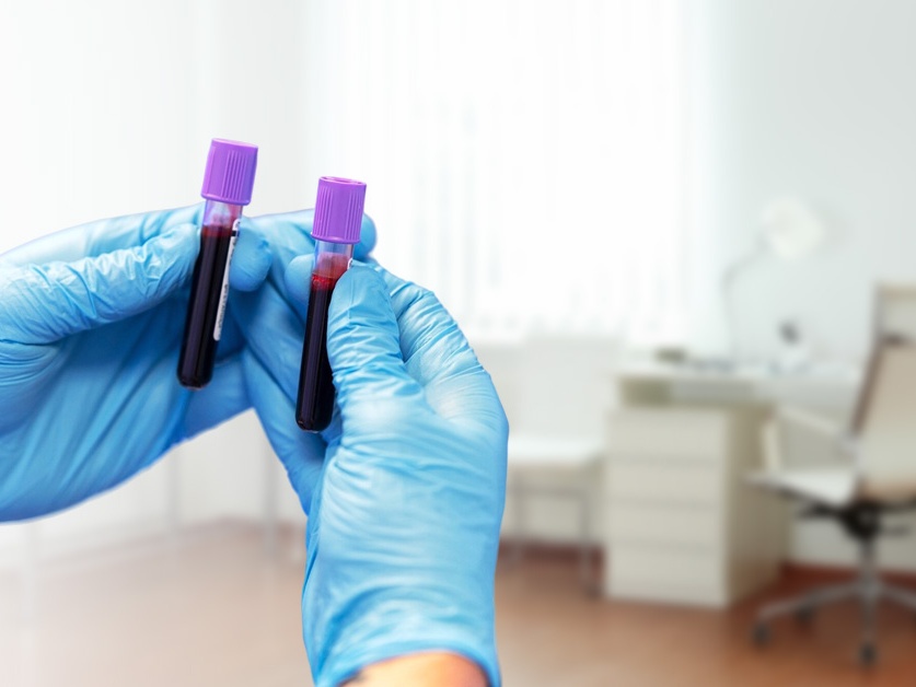 Odběrové místo Poliklinika Nové Strašecí - Masarykova nemocnice Rakovník